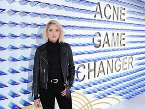 Wajah Berjerawat, Aktris Amerika Ini Pernah Tak Mau Keluar Rumah