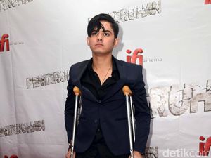 Duh, Aliando Alami Kecelakaan Saat Renang