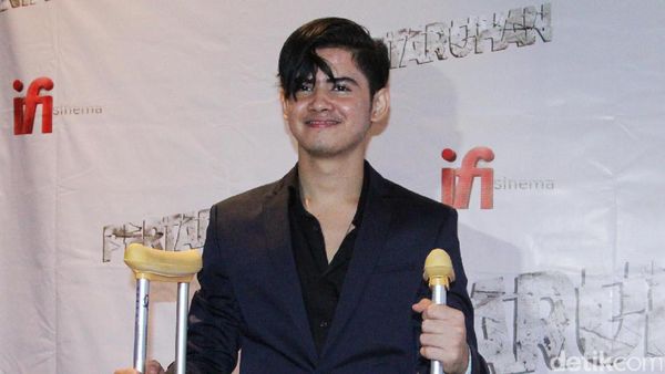 Pakai Tongkat, Aliando Tetep Ganteng Lho Girls!