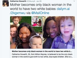 Satu-satunya di Dunia, Ibu Kulit Hitam Lahirkan Bayi Kulit Putih Dua Kali