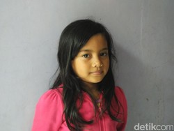 Seekor Lintah Hidup di Hidung Bocah Asal Depok Selama Satu Bulan