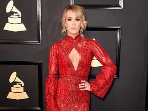 Seperti Carrie Underwood, 6 Artis Ini Juga Punya Bekas Luka Seperti Carrie Underwood, 6 Artis Ini Juga Punya Bekas Luka