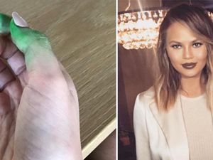 Jari Tangannya Hijau Usai Makan Permen, Chrissy Teigen Minta Bantuan Via Twitter