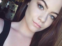 Coba Warnai Alis, Mata Remaja Ini Bengkak dan Hampir Buta