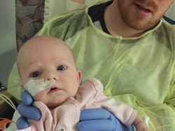 Bayi dengan Usus Terburai ini Bertahan Berkat Operasi di Usia Beberapa Jam