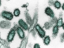 Mengenal Virus H1N1, Penyebab Kematian Suspek Virus Corona di RS Kariadi