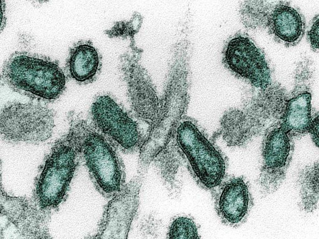9 Virus Mematikan di Dunia, Ada yang Berpotensi Wabah di Indonesia 9 Virus Mematikan di Dunia, Ada yang Berpotensi Wabah di Indonesia