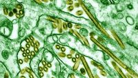 Penampakan Virus Flu Burung Lewat Mikroskop