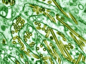 Penampakan Virus Flu Burung Lewat Mikroskop