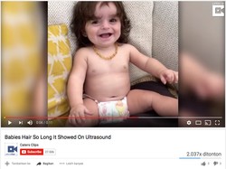 Bukan Pakai Wig! Bayi Ini Memang Terlahir dengan Rambut Lebat