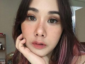 Wanita Tergila-gila Ingin Punya Bintik di Wajah, Hingga Pakai Tato