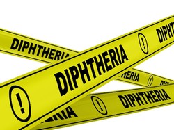 Hingga Kini Aman dari Difteri, Banjarnegara Tetap Waspada