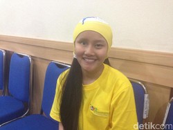 Cerita Julia tentang Bola Mata Palsunya