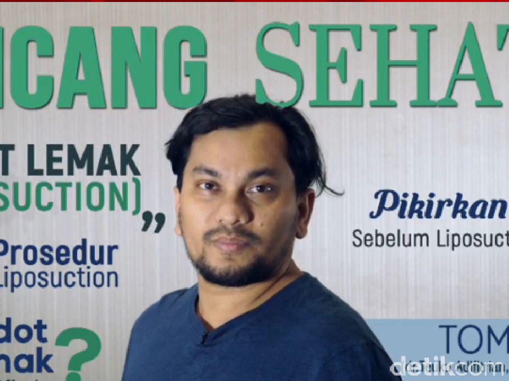 Video: A-Z tentang Sedot Lemak Bersama Tompi Video: A-Z tentang Sedot Lemak Bersama Tompi