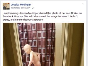 Kisah Menyentuh di Balik Foto Bocah Laki-laki Berkepala Plontos