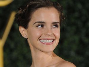 Pose Tanpa Bra, Emma Watson Disebut Munafik Pose Tanpa Bra, Emma Watson Disebut Munafik