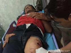 Ini Kronologi Pelemparan Bondet yang Menimpa Polisi Mojokerto