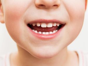 Aturan Konsumsi Asupan Manis agar Anak Tak Gampang Sakit Gigi Aturan Konsumsi Asupan Manis agar Anak Tak Gampang Sakit Gigi