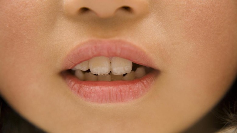 Cara Jitu Mengajari Anak Merawat Kesehatan Gigi dan Mulut/ Foto: ilustrasi/thinkstock