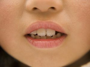 Ilmuwan Jepang Teliti Obat Penumbuh Gigi Baru, Bye-bye Implan-Gigi Palsu