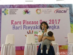 Jadi Duta Penyakit Langka, Ini Pesan Andien untuk Orang Tua dan Dokter