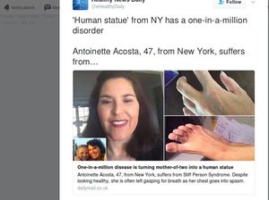 Gerak Sedikit Saja, Wanita Ini Bisa Tiba-tiba Kejang dan Kaku