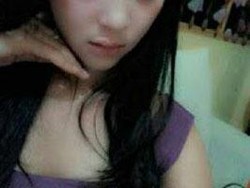 Pemandu Lagu Cantik yang Disiram Air Keras Akhirnya Meninggal