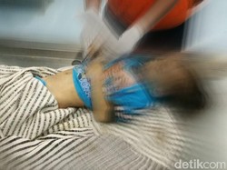 Balita 4 Tahun di Bogor Tewas Tak Wajar, Ayah Tiri Jadi Tersangka