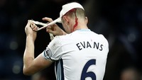 Jonny Evans mendapat perban di kepalanya setelah mengalami cedera dan pendarahan (Foto: Reuters / Peter Nicholls Livepic)