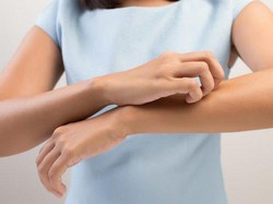 Ini 5 Bahan Alami yang Manjur untuk AtasI Gatal Kudis