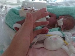 Abiageal, Bayi Termuda yang Survive Pasca Dibedah Perutnya