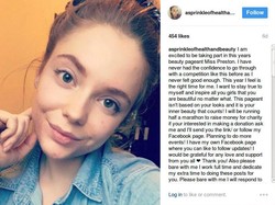 Wanita Ini Ungkap Diet Vegan Bantu Atasi Jerawat yang Penuhi Wajahnya