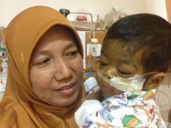 Perjuangan Naura Selesai, Bayi Pengidap Atresia Bilier Ini Telah Berpulang