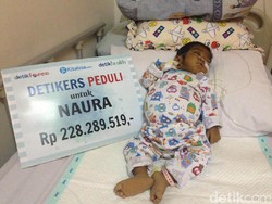 Donasi Detikers Bantu Bayi Naura Jalani Transplantasi Hati