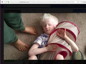 Perjalanan Orion, Bocah yang Tuli, Buta dan Bisu karena Kondisi Langka