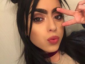 Wanita Ini Ciptakan Karya Seni dari Kelainan Kulit yang Dideritanya