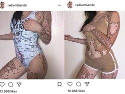 Saat Belang di Kulit Akibat Vitiligo Menjadi Seni yang Indah