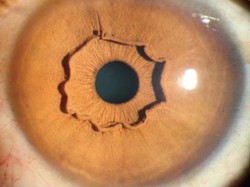 Bagian Tengah Mata Wanita Ini Seperti Berapi-api, Ada Apa Ya?