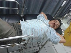 Pria Ini Selamat Setelah Tertabrak Kereta dan Terpental 7 Meter