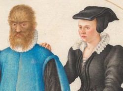 Sindrom Manusia Serigala di Balik Kisah Beauty and The Beast Sindrom Manusia Serigala di Balik Kisah Beauty and The Beast