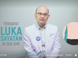 Waspada Tetap Perlu, Tapi Pencurian Organ Tak Semudah yang Dibayangkan