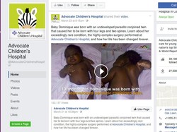 Operasi Sukses, Bayi dengan 4 Kaki dan 2 Tulang Belakang Bisa Hidup Normal