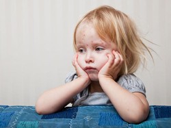 Si Kecil Kena Cacar? Ini Makanan yang Sebaiknya Dikonsumsi dan Dihindari