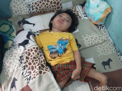 Kisah Fahry, Balita Asal Cilegon yang Kena Radang Otak dan Gizi Buruk