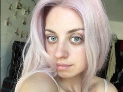 Jangan Malu Punya Stretch Marks, Seperti Wanita yang Fotonya Viral Ini