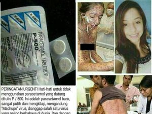 Parasetamol Bervirus Bikin Ruam dan Lepuh? Jangan Langsung Percaya