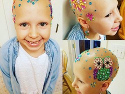 Anak Perempuan Ini Buktikan Bisa Tetap Cantik dengan Kepala Botak
