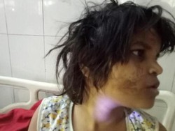 Hidup Bersama Monyet, Bocah India Diselamatkan dari Hutan