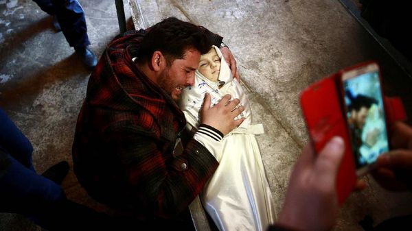 Amira Skaff, Bayi Mungil Korban Perang Suriah