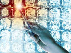 Operasi Tepat Pengangkatan Tumor